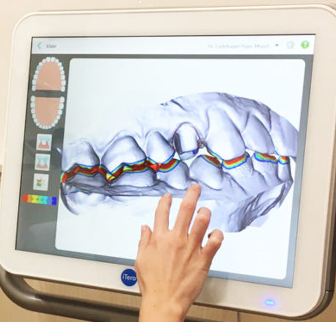 Diagnóstico Digital Odontológico - Centro Medico Cemirt