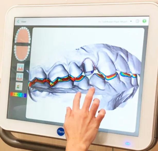 Diagnóstico odontológico con tecnología 3D